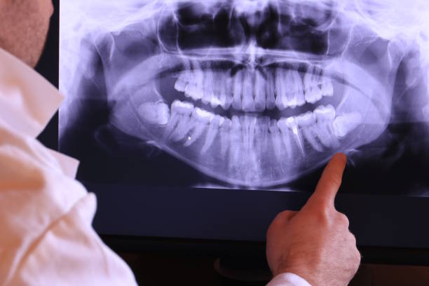 Best Holiday Emergency Dentist in Mledgevle, IL
