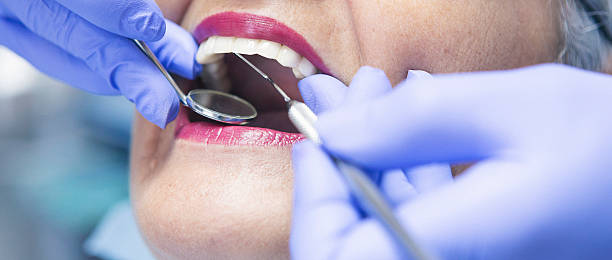 Best Emergency Dental Services for Seniors in Mledgevle, IL