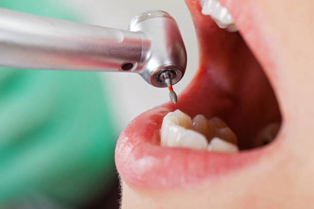 Best Weekend Emergency Dentist in Mledgevle, IL